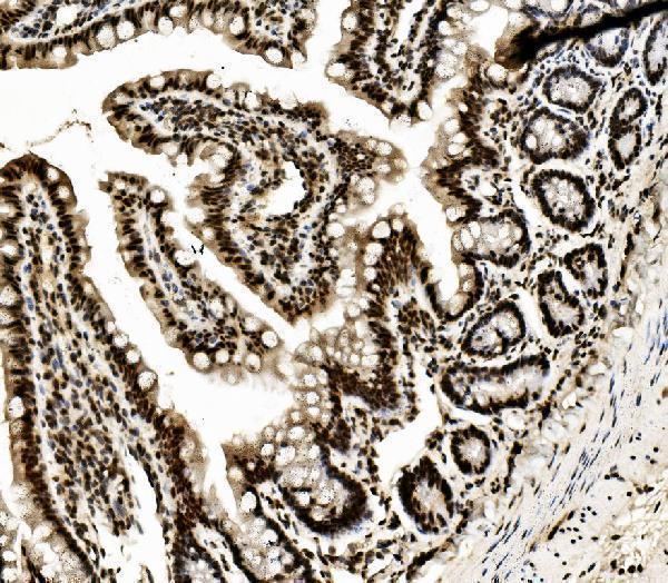m00670 1 ddx5 primary antibodies ihc testing 3