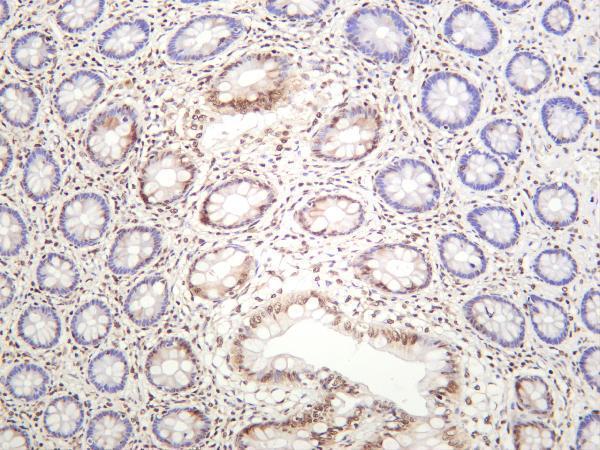 Human colon was stained with anti-DDX5 rabbit antibody
