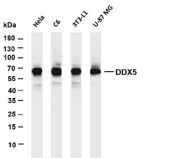 Various whole cell lysates were separated by 4-20% SDS-PAGE, and the membrane was blotted with anti-DDX5 antibody