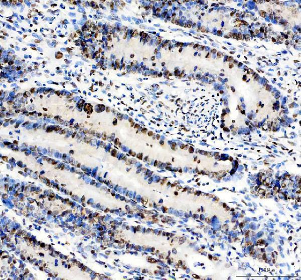  IHC analysis of DDX5 using anti-DDX5 antibody (M00670)