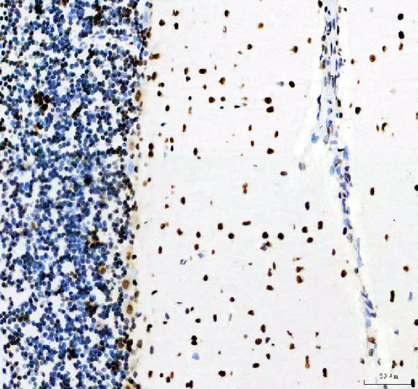  IHC analysis of DDX5 using anti-DDX5 antibody (M00670)