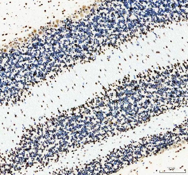 m00670 ddx5 primary antibodies ihc testing 4