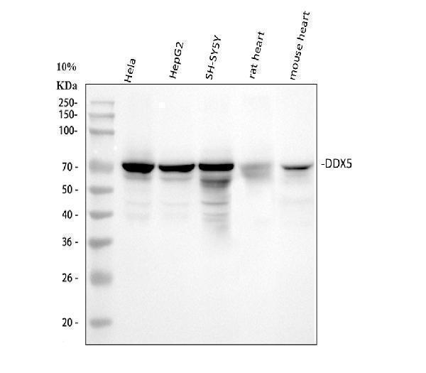  Western blot analysis of DDX5 using anti-DDX5 antibody (M00670)