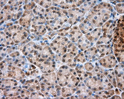 Immunohistochemical staining of paraffin-embedded pancreas tissue within the normal limits using anti-PIM2 mouse monoclonal antibody