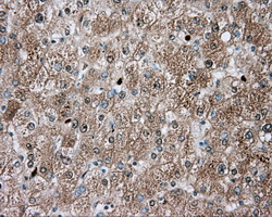 m00671 1 anti tpmt mouse monoclonal antibody clone id oti4c1 ihc testing 4