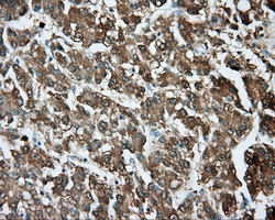 m00671 1 anti tpmt mouse monoclonal antibody clone id oti4c1 ihc testing 5