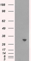 HEK293T cells were transfected with the pCMV6-ENTRY control (Left lane) or pCMV6-ENTRY TPMT (Right lane) cDNA for 48 hrs and lysed