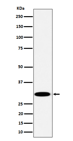 Western blot analysis of TPMT expression in Jurkat cell lysate