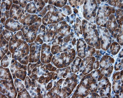 m00671 anti tpmt mouse monoclonal antibody clone id oti2a2 ihc testing 4
