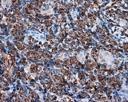 m00671 anti tpmt mouse monoclonal antibody clone id oti2a2 ihc testing 5