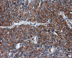 m00671 anti tpmt mouse monoclonal antibody clone id oti2a2 ihc testing 6