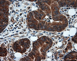 m00671 anti tpmt mouse monoclonal antibody clone id oti2a2 ihc testing 7