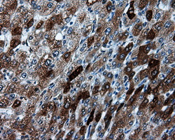 m00671 anti tpmt mouse monoclonal antibody clone id oti2a2 ihc testing 8