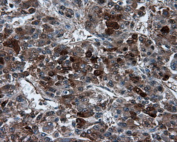 m00671 anti tpmt mouse monoclonal antibody clone id oti2a2 ihc testing 9