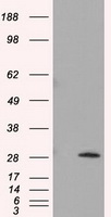HEK293T cells were transfected with the pCMV6-ENTRY control (Left lane) or pCMV6-ENTRY TPMT (Right lane) cDNA for 48 hrs and lysed