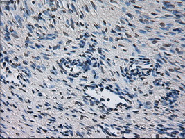 m00672 1 anti cytochrome p450 2e1 cyp2e1 mouse monoclonal antibody clone id oti5f11 ihc testing 2