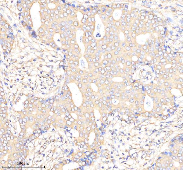  IHC analysis of SGK1 using anti-SGK1 antibody (M00673)