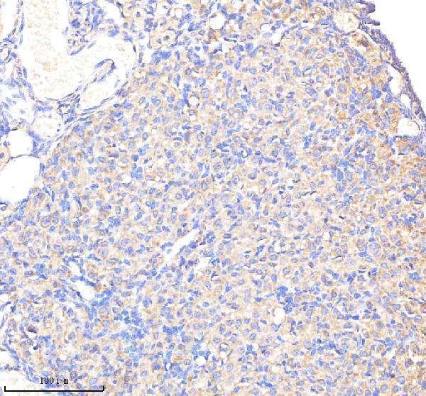 m00673 sgk1 primary antibodies ihc testing 3
