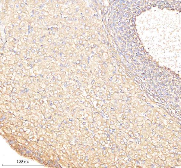 m00673 sgk1 primary antibodies ihc testing 4
