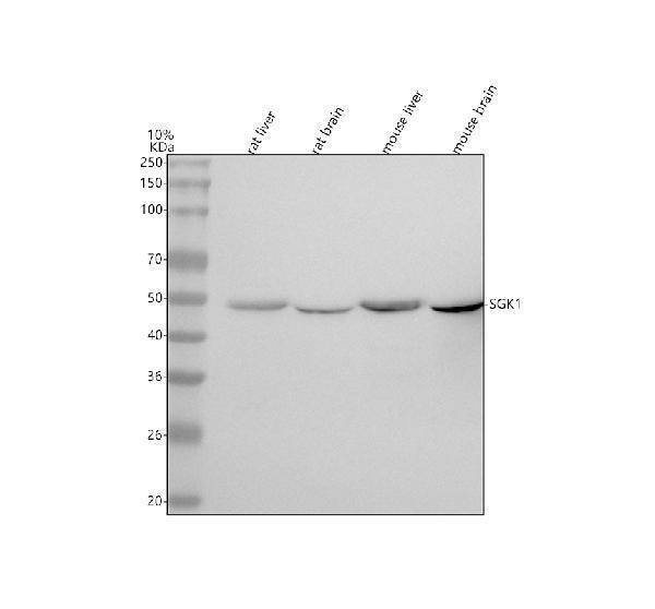 Western blot analysis of SGK1 using anti-SGK1 antibody (M00673)