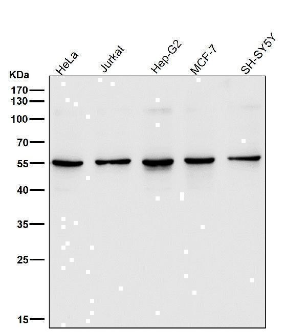 All lanes use the Antibody at 1:1K dilution for 1 hour at room temperature