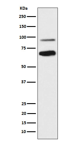 Western blot analysis of TCF4 expression in SH-SY5Y cell lysate