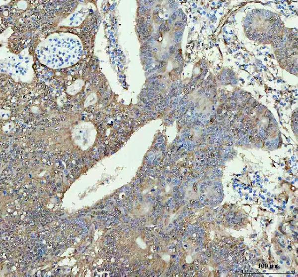  IHC analysis of HSPB1 using anti-HSPB1 antibody (M00676-2)