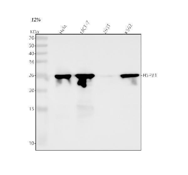  Western blot analysis of HSPB1 using anti-HSPB1 antibody (M00676-2)