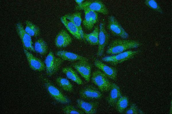 m00676 5 hsp27 primary antibodies if testing 5