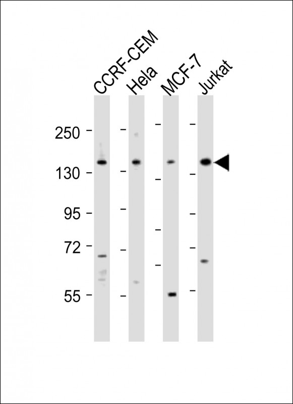 All lanes : Anti-PLCG1 Antibody (Center) at 1:2000 dilutionLane 1: CCRF-CEM whole cell lysatesLane 2: Hela whole cell lysatesLane 3: MCF-7 whole cell lysatesLane 4: Jurkat whole cell lysatesLysates/proteins at 20 µg per lane