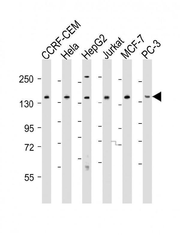 All lanes : Anti-PLCG1 Antibody (Center) at 1:2000 dilutionLane 1: CCRF-CEM whole cell lysatesLane 2: Hela whole cell lysatesLane 3: HepG2 whole cell lysatesLane 4: Jurkat whole cell lysatesLane 5: MCF-7 whole cell lysatesLane 6: PC-3 whole cell lysatesLysates/proteins at 20 µg per lane