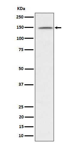 Western blot analysis of phospho-Phospholipase C gamma 1/PLC-gamma-1 (Y1253) expression in Jurkat treated with Pervanadate lysate