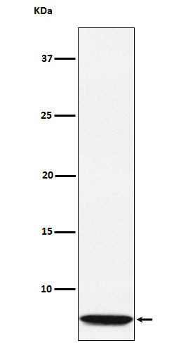 Western blot analysis of GLP2 expression in GLP2 recombinant protein lysate