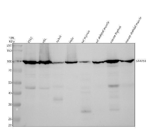 m00681 stat5b primary antibodies wb testing 2