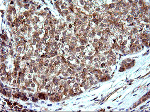 m00682 1 anti sex hormone binding globulin shbg mouse monoclonal antibody clone id oti1h10 ihc testing 10
