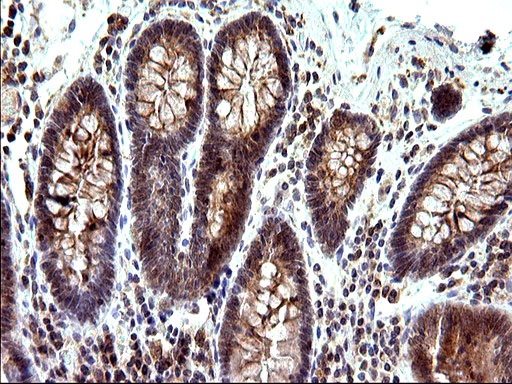 m00682 1 anti sex hormone binding globulin shbg mouse monoclonal antibody clone id oti1h10 ihc testing 7