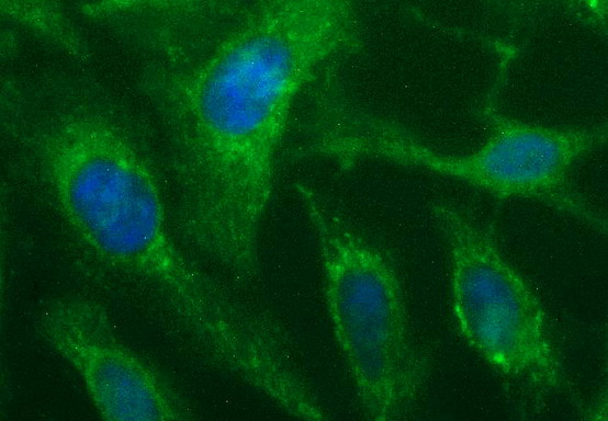 Immunofluorescent staining of HeLa cells using anti-SHBG mouse monoclonal antibody (M00682-2)