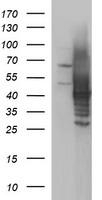 HEK293T cells were transfected with the pCMV6-ENTRY control (Left lane) or pCMV6-ENTRY SHBG (Right lane) cDNA for 48 hrs and lysed
