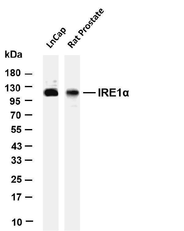 Various whole cell lysates were separated by 4-20% SDS-PAGE, and the membrane was blotted with anti-IRE1α antibody
