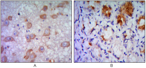 Immunohistochemistry validation of ERN1 using Anti-IRE alpha ERN1 Monoclonal Antibody (M00683)