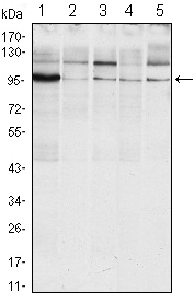 Western blotting validation for Anti-IRE alpha ERN1 Monoclonal Antibody M00683
Western Blot (WB) analysis using IRE1alpha Monoclonal Antibody against Raji (1)