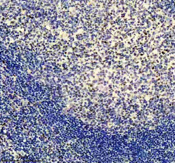 IHC analysis of Egr1 using anti-Egr1 antibody (M00687)