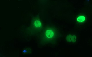 Anti-TP73 mouse monoclonal antibody (M00688-1) immunofluorescent staining of COS7 cells transiently transfected by pCMV6-ENTRY TP73