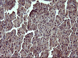 Immunohistochemical staining of paraffin-embedded Human pancreas tissue within the normal limits using anti-TP73 mouse monoclonal antibody