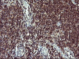 m00688 1 anti p73 tp73 mouse monoclonal antibody clone id oti1b5 ihc testing 5
