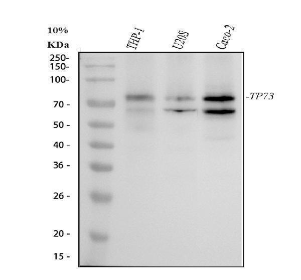  Western blot analysis of p73 using anti-p73 antibody (M00688)