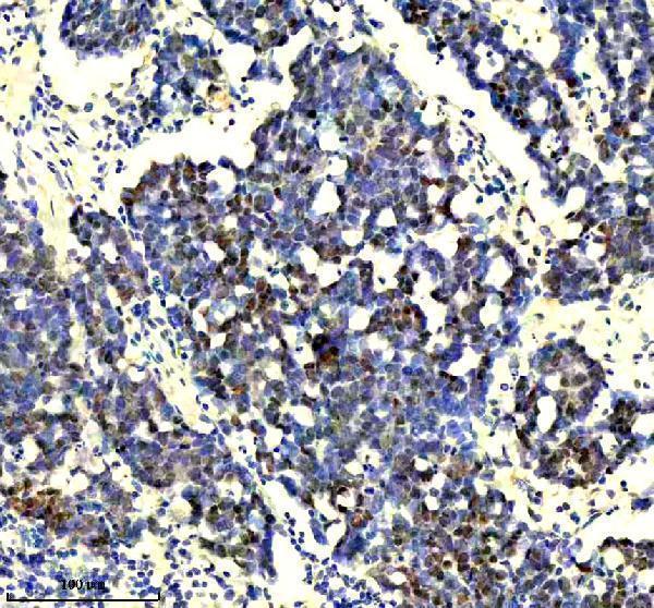 m00688 tp73 primary antibodies ihc testing 1