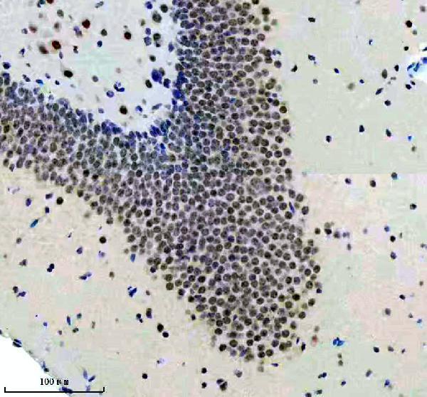 m00688 tp73 primary antibodies ihc testing 2
