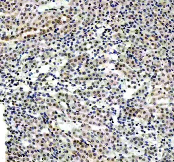 m00688 tp73 primary antibodies ihc testing 4