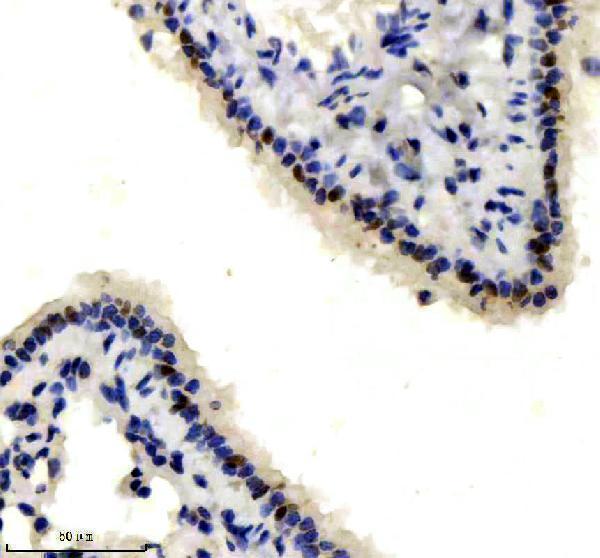IHC analysis of TP73 using anti-TP73 antibody (M00688)